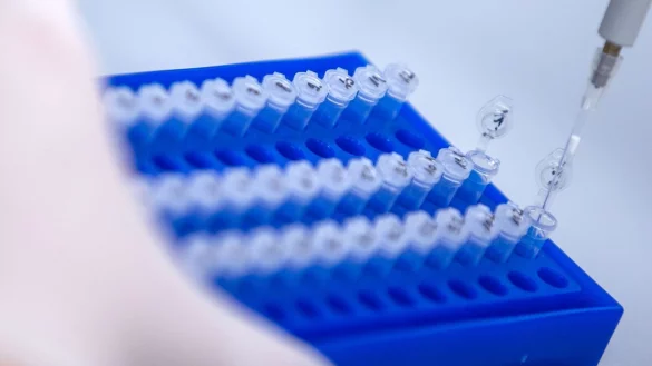 Sequenzierproben helfen bei Untersuchungen von Corona-Varianten. - &copy; Jens B&uuml;ttner/dpa-Zentralbild/dpa