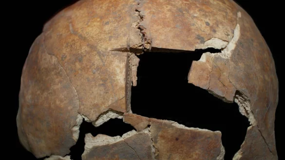 Diese Nahaufnahme zeigt den Sch&auml;del mit der Trepanation. - &copy; Rachel Kalisher/dpa