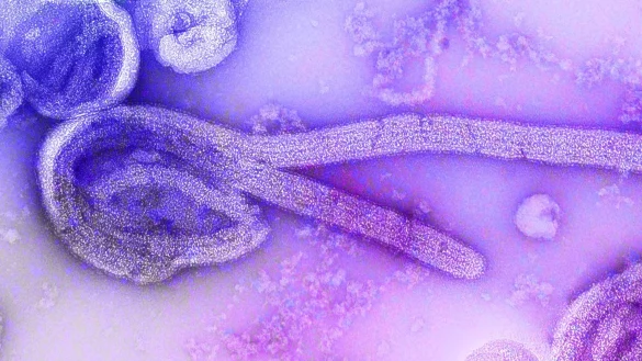 Eine elektronenmikroskopische Aufnahme eines Marburg-Virus. - &copy; Dr. Frederick Murphy/CDC/dpa