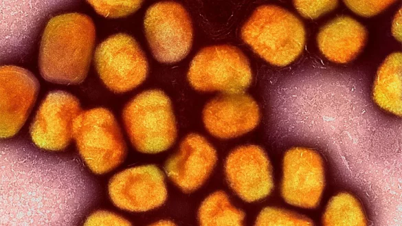 Eine kolorierte transmissionselektronenmikroskopische Aufnahme von Partikeln des Affenpockenvirus. Die WHO hat wegen Mpox-Ausbr&uuml;chen in zahlreichen L&auml;ndern 2022 eine internationale Notlage ausgerufen. - &copy; Niaid/Niaid/Planet Pix via ZUMA Press Wire/dpa