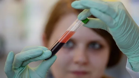 Bluttests, die Kenntnis &uuml;ber gewisse Erbgutfehler beim Baby versprechen, werden in bestimmten F&auml;llen von den Kassen bezahlt. - &copy; Patrick Seeger/dpa/dpa-tmn