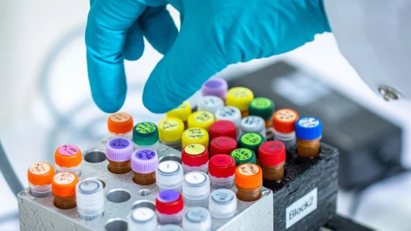 Ehec bezeichnet bestimmte krankmachende St&auml;mme des Darm-Bakteriums, die vor allem bei Wiederk&auml;uern wie Rindern vorkommen (Archivbild). - &copy; Jens B&uuml;ttner/dpa