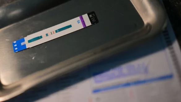 HIV-Diagnosen werden oft erst Jahre nach der Infektion gestellt. (Symbolbild) - &copy; Sebastian Gollnow/dpa