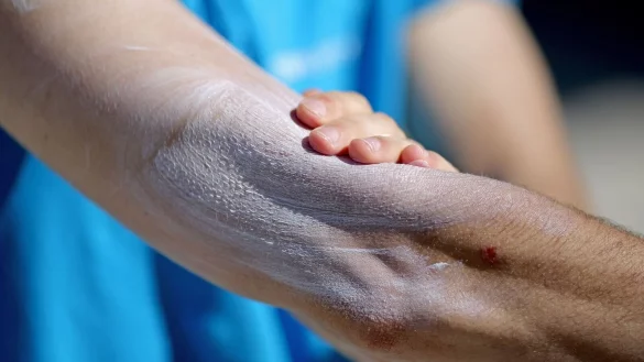 Ein Mann verreibt Sonnencreme auf seinem Arm. Einer aktuellen Umfrage zufolge nutzt gut ein Drittel aller Befragten im Fr&uuml;hjahr und Sommer normalerweise kein Sonnenschutzmittel. - &copy; Jan Woitas/dpa-Zentralbild/dpa