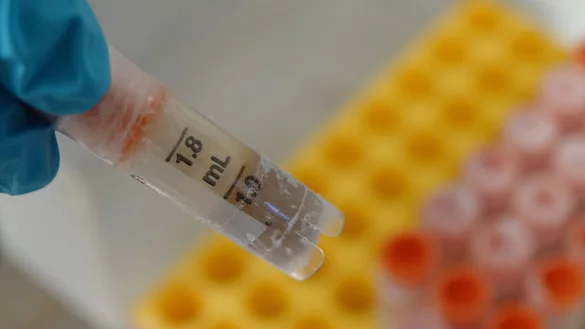 Eine eingefrorene Stuhlprobe in einem Gläschen. - © Christiane Oelrich/dpa