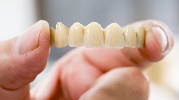 Hochwertiger Zahnersatz ist teuer. Welche Zahnzusatzversicherungen sich lohnen, haben die Experten der Zeitschrift &laquo;Finanztest&raquo; ermittelt. - &copy; Markus Scholz/dpa-tmn