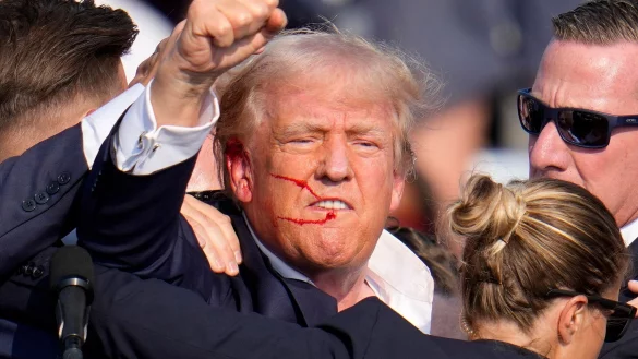 Trump wurde bei dem Attentat im Juli am Ohr verletzt. (Archivbild) - © Gene J. Puskar/AP/dpa