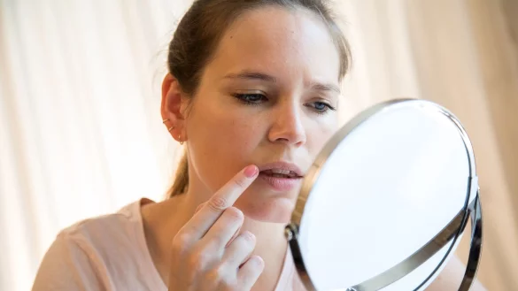 Bildet sich da etwa Herpes? Rezeptfreie Arzneimittel sowie Medizinprodukte versprechen eine schnellere Heilung. Die Stiftung Warentest ist nicht &uuml;berzeugt. - &copy; Christin Klose/dpa-tmn