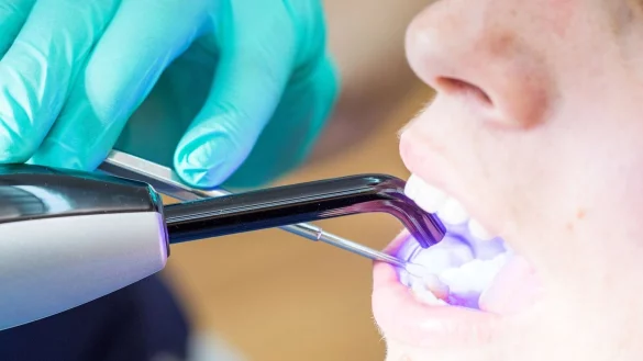 Laut KZBV-Vorstandschef Hendges gehen bei fachgerechtem Einsatz von Dentalamalgam keine Gesundheitsgefahren aus. - &copy; Christin Klose/dpa