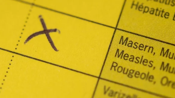 Bei Masern handelt es sich laut RKI um eine der ansteckendsten Krankheiten beim Menschen &uuml;berhaupt. - &copy; Marius Becker/dpa