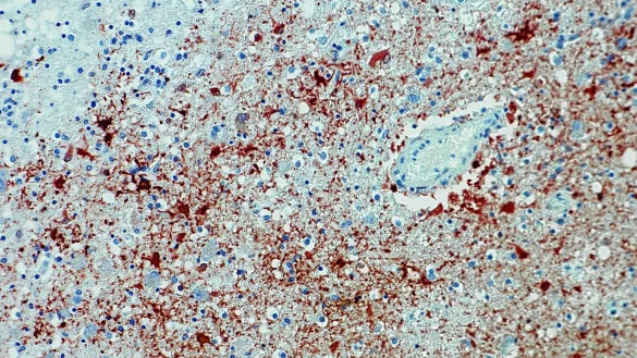 Die undatierte Aufnahme zeigt einen Anitk&ouml;rpernachweis zum Borna-Virus im Gewebe. - &copy; Bernhard-Nocht-Institut f&uuml;r Tropenmedizin/dpa