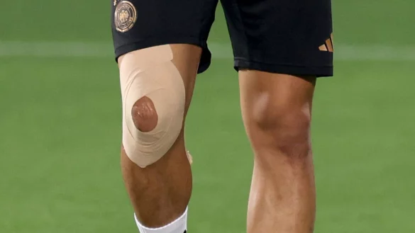 Das l&auml;dierte Knie von Nationalspieler Leroy San&eacute;. - &copy; Christian Charisius/dpa