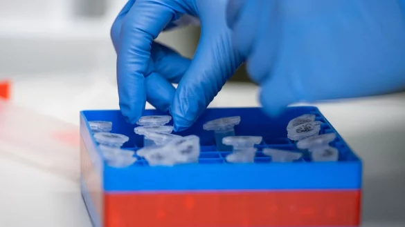 Eine Laborantin sortiert Proben. - &copy; Christophe Gateau/dpa/Symbolbild