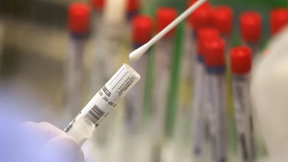 Ein Abstrich wird in einem Labor auf das Coronavirus untersucht. - &copy; Oliver Berg/dpa/Symbolbild