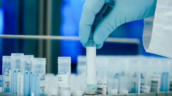 &laquo;Jeder f&auml;lschlich negative Test hat vermutlich zu mehr als zwei zus&auml;tzlichen Infektionen gef&uuml;hrt&raquo; (Symbolbild). - &copy; Uwe Anspach/dpa