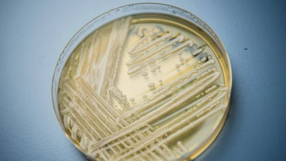 Der Hefepilz Candida auris in einer Petrischale. Die Weltgesundheitsorganisation (WHO) ist besorgt &uuml;ber 19 kranheitserregende Pilze, die nach Expertenansicht die &ouml;ffentliche Gesundheit bedrohen. - &copy; Nicolas Armer/dpa