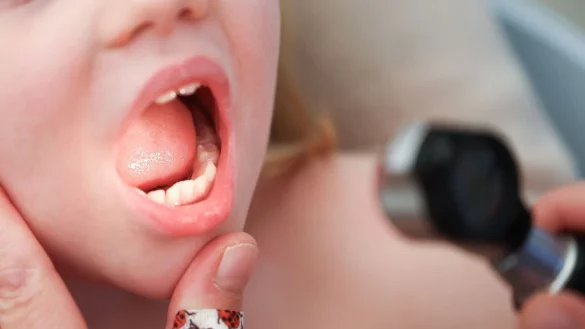 Wegen der angespannten Lage k&ouml;nnen Eltern ab sofort auch bestimmte Vorsorgeuntersuchungen f&uuml;r ihre Kinder vor&uuml;bergehend verschieben. - &copy; Christian Charisius/dpa