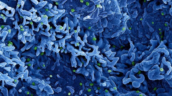 Die Weltgesundheitsorganisation (WHO) benutzt ab sofort statt Monkeypox die Bezeichnung Mpox. - &copy; Niaid/Niaid/Planet Pix via ZUMA Press Wire/dpa