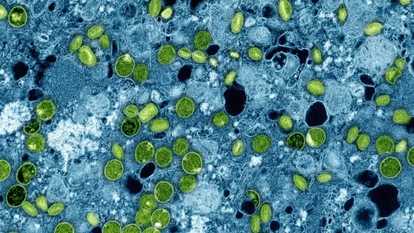 So sehen die Mpox-Viruspartikel unter dem Mikroskop aus. (Archivbild) - © -/NIAID via AP/dpa