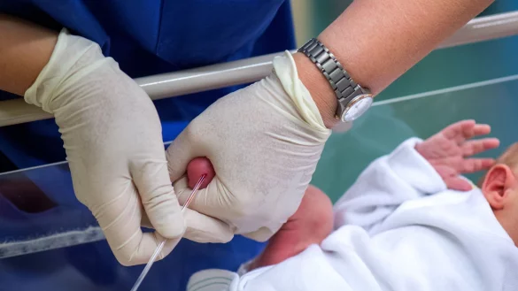 Für das Neugeborenen-Screening werden Babys ein paar Tropfen Blut entnommen, (Archivbild) - © Arno Burgi/dpa-Zentralbild/dpa-tmn