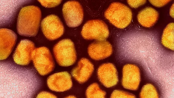 Eine kolorierte transmissionselektronenmikroskopische Aufnahme von Partikeln des Affenpockenvirus. - &copy; Niaid/Niaid/Planet Pix via ZUMA Press Wire/dpa