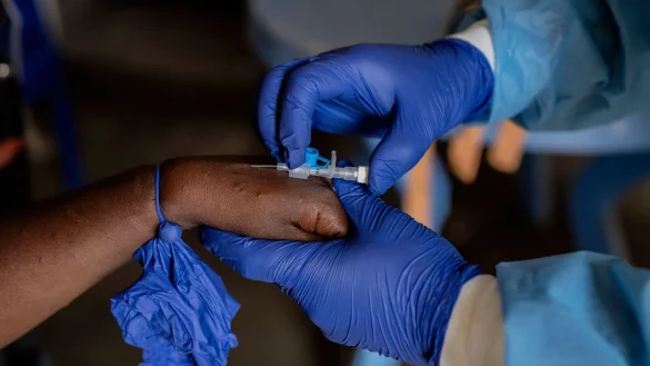 Die Zahl der Mpox-F&auml;lle nimmt in mehreren afrikanischen L&auml;ndern weiter zu (Archivbild). - &copy; Moses Sawasawa/AP/dpa