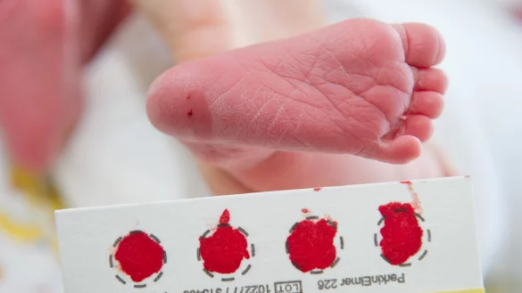 Ein Bluttropfen vom Fuß eines Babys genügt, um viele Krankheit zu erkennen. (Archivbild) - © picture alliance / Stefan Sauer/dpa-Zentralbild/dpa