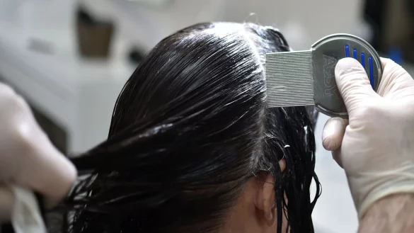 L&auml;stig, aber ungef&auml;hrlich: Weil L&auml;use im trockenen Haar schnell &uuml;bersehen werden, ist das Ausk&auml;mmen im nassen Zustand ratsam. - &copy; Britta Pedersen/dpa-Zentralbild/dpa-tmn