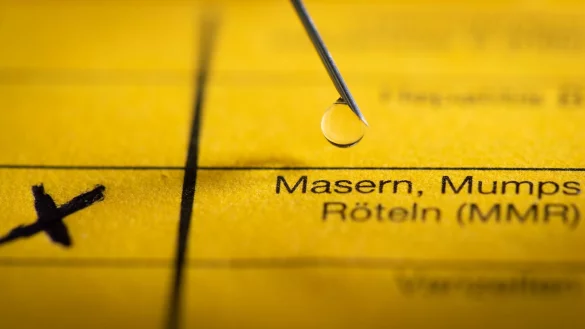 Die Stiko empfiehlt für die Masernimpfung jeweils eine Dosis im Alter von 11 und von 15 Monaten (Symbolbild). - © Friso Gentsch/dpa