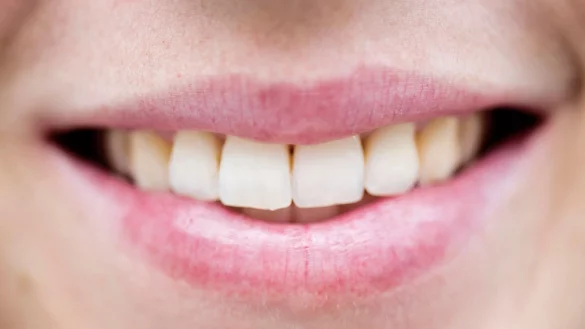 Alle Affen k&ouml;nnen lachen - aber unter allen Primaten haben nur Menschen eine Sprache herausgebildet. - &copy; picture alliance / dpa