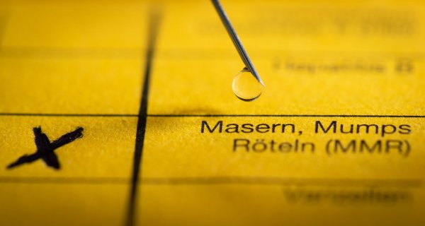 Die Stiko empfiehlt für die Masernimpfung jeweils eine Dosis im Alter von 11 und von 15 Monaten (Symbolbild). - © Friso Gentsch/dpa