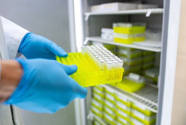 Ehec steht für enterohämorrhagische Escherichia coli und bezeichnet bestimmte krankmachende Stämme dieses im Darm vorkommenden Bakteriums. - © Guido Kirchner/dpa