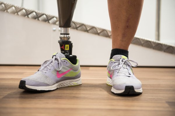 Prothese - © Foto: Andreas Arnold/dpa