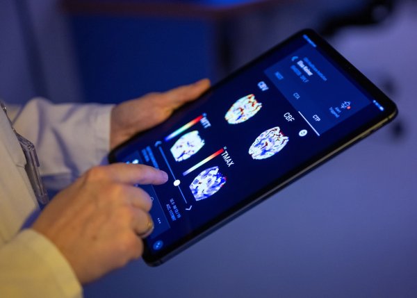 Gehirnbilder eines Patienten in einer KI-basierten App. Nach einer Deloitte-Umfrage sehen viele Bürgerinnen und Bürger den Einsatz von KI in der Medizin skeptisch, vor allem wenn es um die Therapie geht. (Symbolbild) - © Monika Skolimowska/dpa