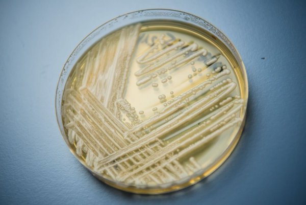 Der Hefepilz Candidozyma auris (früher bekannt als Candida auris). - © Nicolas Armer/dpa