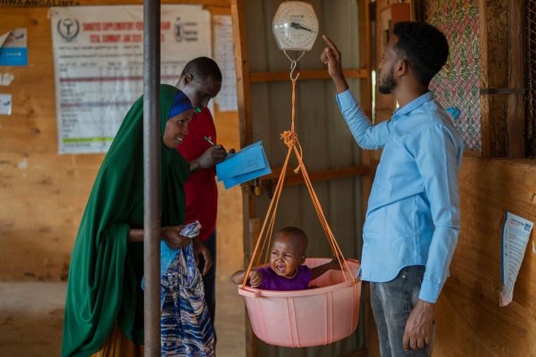 Ein Kind wird in einem Flüchtlingslager in Somalia gewogen. - © Jerome Delay/AP/dpa
