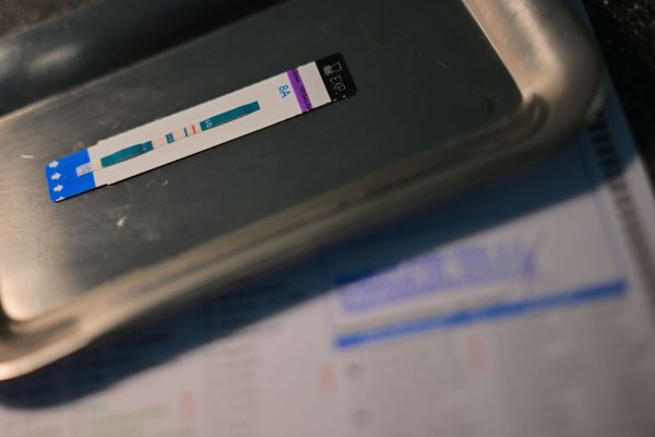 HIV-Diagnosen werden oft erst Jahre nach der Infektion gestellt. (Symbolbild) - © Sebastian Gollnow/dpa