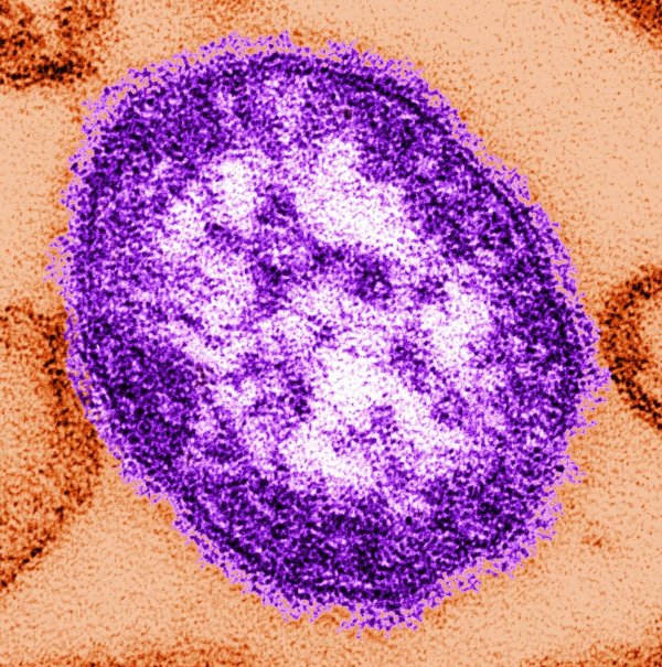Zahl der Masernfälle in Europa auf Höchststand seit mehr als 25 Jahren. (Archivbild) - © Cynthia Goldsmith/Centers for Disease Control and Prevention/dpa