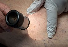 Illustration - Haut - Peter Kneffel/dpa