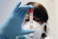 Corona-Test - Foto: Hans Klaus Techt/APA/dpa