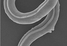 Fadenwürmer aus Permafrost - A. V. Tchesunov/A. Shatilovich/Institute of Physicochemical and Biological Problems in Soil Science RAS/dpa