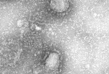 Coronavirus - Foto: IVDC/China CDC via GISAID/dpa