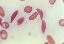 Genschere - F. Gilbert/CDC/AP