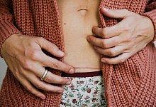 Eine Frau berührt ihre Kaiserschnittnarbe - Gemma Ferrando/Westend61/dpa-tmn