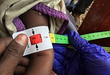 Tausende Kinder in Nord-Darfur von Hungertod bedroht - Eva-Maria Krafczyk/dpa