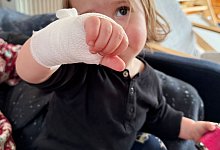 Brandwunde bei einem Kleinkind - Till Simon Nagel/dpa-tmn