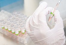 Eine biologisch-technische Assistentin bereitet PCR-Tests f&uuml;r die Analyse vor. - Julian Stratenschulte/dpa/Symbolbild