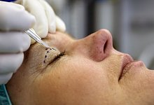 Sch&ouml;nheitsoperation - Foto: Jens Schierenbeck