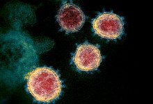 Coronavirus - Foto: Uncredited/NIAID-RML/AP/dpa