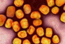 Affenpockenvirus - Niaid/Niaid/Planet Pix via ZUMA Press Wire/dpa